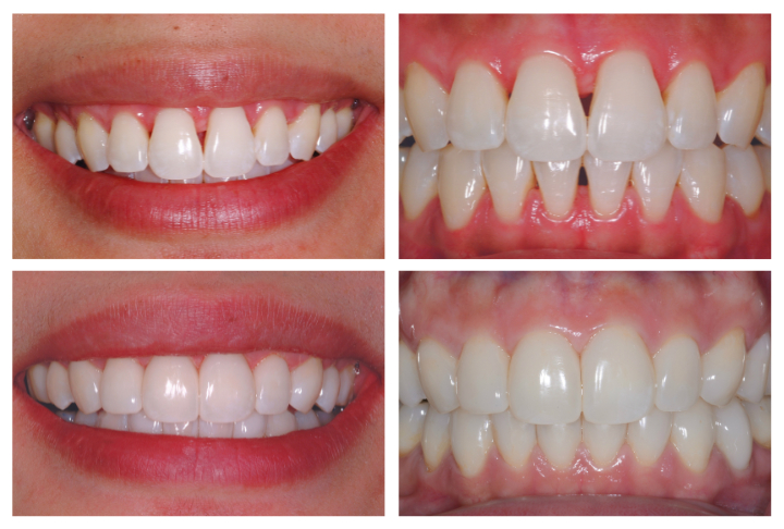 Cosmetic Dentist in Temecula